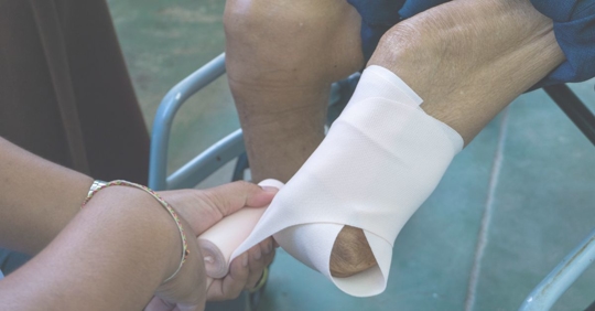 a leg amputee getting leg wrapped